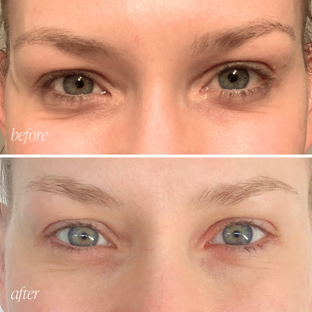 Rejuvenation Eye Cream