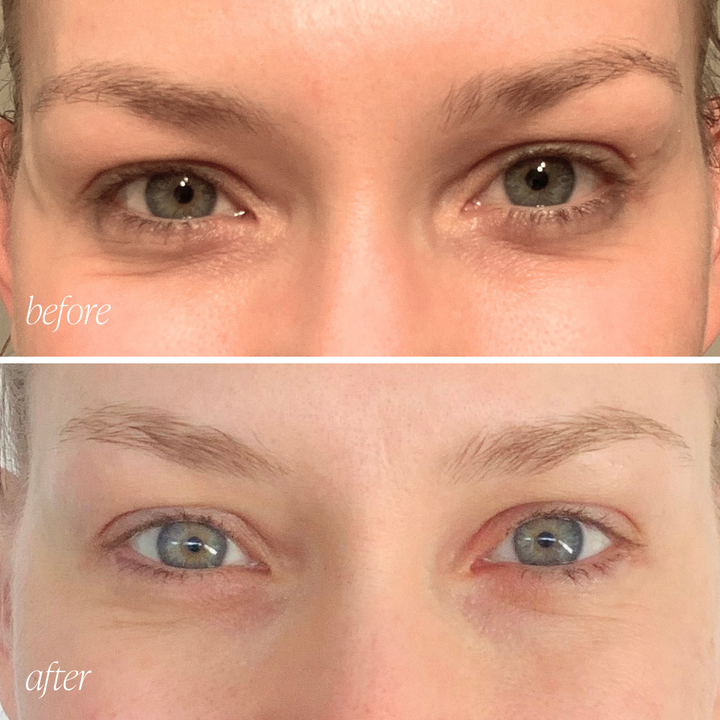 Rejuvenation Eye Cream